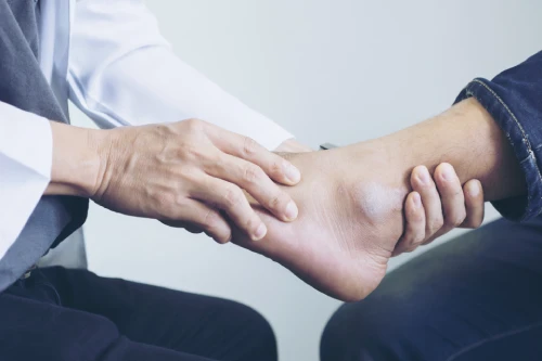 Ankle sprain treatment in Somerset