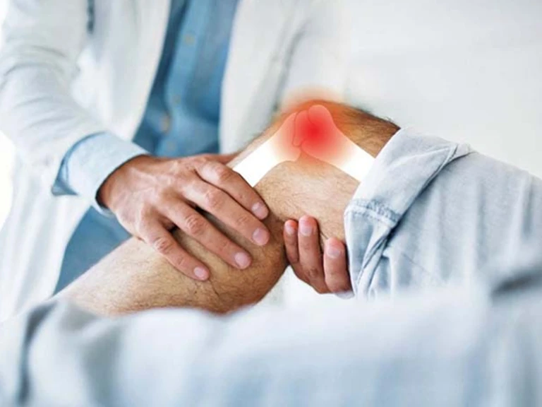 Arthritis treatment